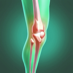 МРТ коленного сустава