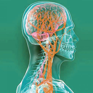 МРТ сосудов головного мозга (артерий)